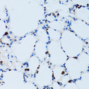 SPN / CD43 Antibody - Immunohistochemistry of paraffin-embedded mouse lung tissue.