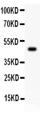 SPN / CD43 Antibody - Western blot testing of CD43 antibody (0.5ug/ml) and recombinant human protein (0.5ng)