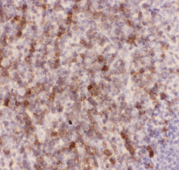 SPN / CD43 Antibody - IHC-P: CD43 antibody testing of mouse spleen tissue
