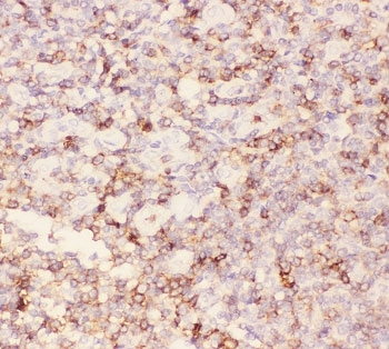 SPN / CD43 Antibody - IHC-P: CD43 antibody testing of human tonsil tissue. HIER: steamed with pH6 citrate buffer.