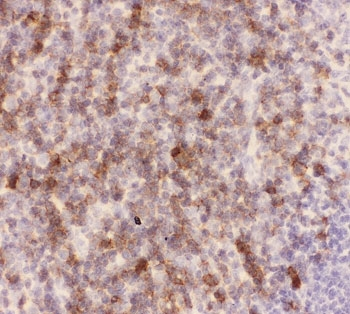SPN / CD43 Antibody - IHC-P: CD43 antibody testing of mouse spleen tissue. HIER: steamed with pH6 citrate buffer.