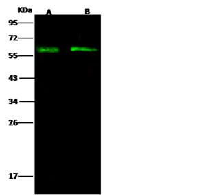SPN / CD43 Antibody - Anti-CD43 rabbit polyclonal antibody at 1:500 dilution. Lane A: SKBR3 Whole Cell Lysate. Lane B: HL60 Whole Cell Lysate. Lysates/proteins at 30 ug per lane. Secondary: Goat Anti-Rabbit IgG H&L (Dylight 800) at 1/10000 dilution. Developed using the Odyssey technique. Performed under reducing conditions. Predicted band size: 40 kDa. Observed band size: 59 kDa.