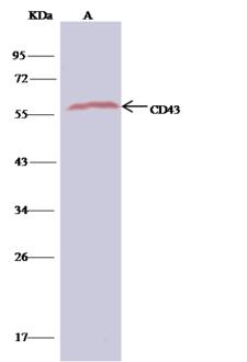 SPN / CD43 Antibody - CD43 was immunoprecipitated using: Lane A: 0.5 mg Jurkat Whole Cell Lysate. 1 uL anti-CD43 rabbit polyclonal antibody and 60 ug of Immunomagnetic beads Protein G. Primary antibody: Anti-CD43 rabbit polyclonal antibody, at 1:500 dilution. Secondary antibody: Clean-Blot IP Detection Reagent (HRP) at 1:500 dilution. Developed using the DAB staining technique. Performed under reducing conditions. Predicted band size: 55 kDa. Observed band size: 55 kDa.