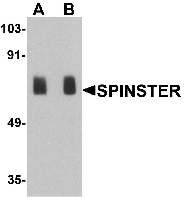 SPNS1 / Spinster Antibody - Western blot analysis of SPINSTER in human placenta tissue lysate with SPINSTER antibody at (A) 1 and (B) 2 ug/ml.