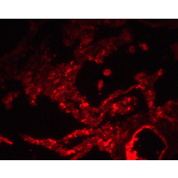 SPNS1 / Spinster Antibody - Immunofluorescence of SPINSTER in human lung tissue with SPINSTER antibody at 20 µg/ml.