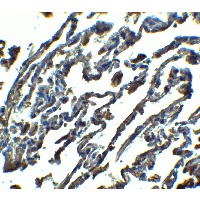 SPNS1 / Spinster Antibody - Immunohistochemistry of SPINSTER in human lung tissue with SPINSTER antibody at 2.5 µg/ml.