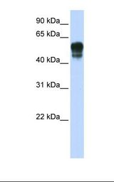SPNS1 / Spinster Antibody - Transfected 293T cell lysate. Antibody concentration: 1.0 ug/ml. Gel concentration: 12%.  This image was taken for the unconjugated form of this product. Other forms have not been tested.