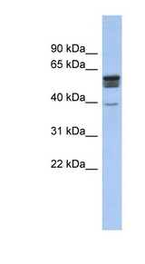 SPNS2 Antibody - SPNS2 antibody Western blot of Fetal Muscle lysate. This image was taken for the unconjugated form of this product. Other forms have not been tested.
