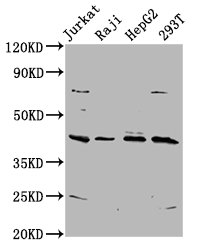 SPO11 Antibody - Western Blot Positive WB detected in: Jurkat whole cell lysate, Raji whole cell lysate, HepG2 whole cell lysate, 293T whole cell lysate All Lanes: SPO11 antibody at 5.8µg/ml Secondary Goat polyclonal to rabbit IgG at 1/50000 dilution Predicted band size: 45, 41 KDa Observed band size: 45 KDa
