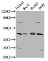 SPO11 Antibody - Western Blot Positive WB detected in: Jurkat whole cell lysate, Raji whole cell lysate, HepG2 whole cell lysate, 293T whole cell lysate All Lanes: SPO11 antibody at 5.8µg/ml Secondary Goat polyclonal to rabbit IgG at 1/50000 dilution Predicted band size: 45, 41 KDa Observed band size: 45 KDa