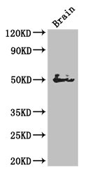 SPOCK1 / SPOCK / Testican Antibody - Western Blot Positive WB detected in:Mouse brain tissue All Lanes: SPOCK1 antibody at 2.7ug/ml Secondary Goat polyclonal to rabbit IgG at 1/50000 dilution Predicted band size: 50 kDa Observed band size: 50 kDa