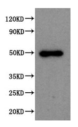 SPOCK1 / SPOCK / Testican Antibody - Western Blot Positive WB detected in: 293T whole cell lysate All lanes: SPOCK1 antibody at 1:2000 Secondary Goat polyclonal to rabbit IgG at 1/50000 dilution Predicted band size: 50 kDa Observed band size: 50 kDa