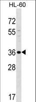 SPOCK3 Antibody - SPOCK3 Antibody western blot of HL-60 cell line lysates (35 ug/lane). The SPOCK3 antibody detected the SPOCK3 protein (arrow).