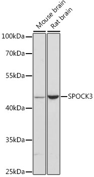 SPOCK3 Antibody - Western blot analysis of extracts of various cell lines, using SPOCK3 antibody at 1:3000 dilution. The secondary antibody used was an HRP Goat Anti-Rabbit IgG (H+L) at 1:10000 dilution. Lysates were loaded 25ug per lane and 3% nonfat dry milk in TBST was used for blocking. An ECL Kit was used for detection and the exposure time was 90s.