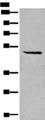 SPOCK3 Antibody - Western blot analysis of HL-60 cell lysate  using SPOCK3 Polyclonal Antibody at dilution of 1:400