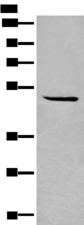 SPOCK3 Antibody - Western blot analysis of HL-60 cell lysate  using SPOCK3 Polyclonal Antibody at dilution of 1:400
