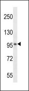 SPON1 / F-Spondin Antibody - VSGP/F-spondin Antibody western blot of mouse kidney tissue lysates (35 ug/lane). The VSGP/F-spondin antibody detected the VSGP/F-spondin protein (arrow).