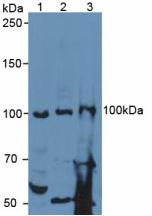 SPON1 / F-Spondin Antibody - Western Blot; Sample: Lane1: Human Liver Tissue; Lane2: Mouse Lung Tissue; Lane3: Mouse Brain Tissue.