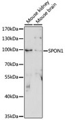 SPON1 / F-Spondin Antibody - Western blot analysis of extracts of various cell lines, using SPON1 antibody at 1:1000 dilution. The secondary antibody used was an HRP Goat Anti-Rabbit IgG (H+L) at 1:10000 dilution. Lysates were loaded 25ug per lane and 3% nonfat dry milk in TBST was used for blocking. An ECL Kit was used for detection and the exposure time was 90s.