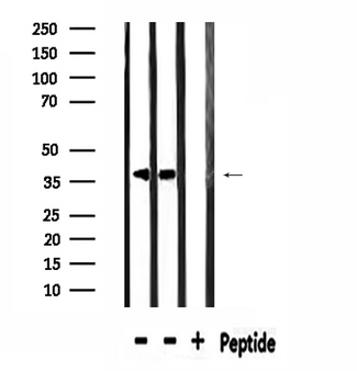 SPON2 / MINDIN Antibody