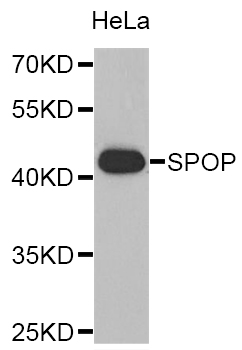 SPOP Antibody - Western blot analysis of extracts of HeLa cells.