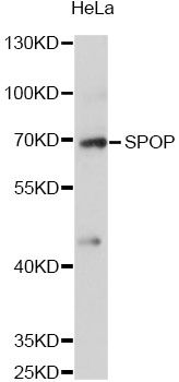 SPOP Antibody - Western blot analysis of extracts of HeLa cells, using SPOP antibody at 1:3000 dilution. The secondary antibody used was an HRP Goat Anti-Rabbit IgG (H+L) at 1:10000 dilution. Lysates were loaded 25ug per lane and 3% nonfat dry milk in TBST was used for blocking. An ECL Kit was used for detection and the exposure time was 60s.