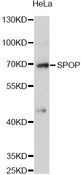 SPOP Antibody - Western blot analysis of extracts of HeLa cells, using SPOP antibody at 1:3000 dilution. The secondary antibody used was an HRP Goat Anti-Rabbit IgG (H+L) at 1:10000 dilution. Lysates were loaded 25ug per lane and 3% nonfat dry milk in TBST was used for blocking. An ECL Kit was used for detection and the exposure time was 60s.