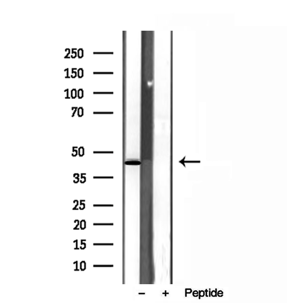 SPOP Antibody - Western blot analysis of extracts of HeLa cells using SPOP antibody.