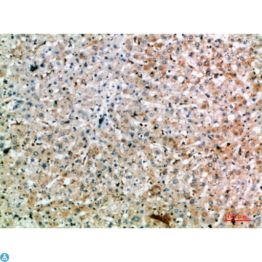 SPOP Antibody - Immunohistochemical analysis of paraffin-embedded human-liver, antibody was diluted at 1:200.