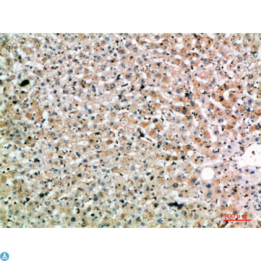 SPOP Antibody - Immunohistochemical analysis of paraffin-embedded human-liver, antibody was diluted at 1:200.