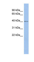 SPOPL Antibody - SPOPL antibody Western blot of PANC1 cell lysate. This image was taken for the unconjugated form of this product. Other forms have not been tested.