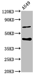SPOPL Antibody - Positive Western Blot detected in A549 whole cell lysate. All lanes: SPOPL antibody at 6.3 µg/ml Secondary Goat polyclonal to rabbit IgG at 1/50000 dilution. Predicted band size: 45 KDa. Observed band size: 45 KDa