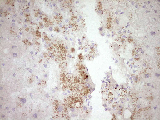 SPP1 / Osteopontin Antibody - Immunohistochemical staining of paraffin-embedded Human liver tissue within the normal limits using anti-SPP1 mouse monoclonal antibody. (Heat-induced epitope retrieval by 1 mM EDTA in 10mM Tris, pH8.5, 120C for 3min,