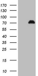 SPP1 / Osteopontin Antibody - HEK293T cells were transfected with the pCMV6-ENTRY control (Left lane) or pCMV6-ENTRY SPP1 (Right lane) cDNA for 48 hrs and lysed. Equivalent amounts of cell lysates (5 ug per lane) were separated by SDS-PAGE and immunoblotted with anti-SPP1.