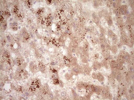 SPP1 / Osteopontin Antibody - IHC of paraffin-embedded Human liver tissue using anti-SPP1 mouse monoclonal antibody. (Heat-induced epitope retrieval by 1 mM EDTA in 10mM Tris, pH8.5, 120°C for 3min).