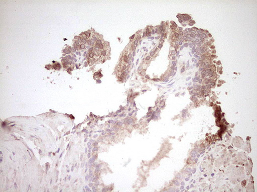 SPP1 / Osteopontin Antibody - IHC of paraffin-embedded Human prostate tissue using anti-SPP1 mouse monoclonal antibody. (Heat-induced epitope retrieval by 1 mM EDTA in 10mM Tris, pH8.5, 120°C for 3min).