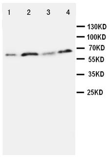 SPP1 / Osteopontin Antibody - WB of SPP1 / Osteopontin antibody. Lane 1: MM231 Cell Lysate. Lane 2: HELA Cell Lysate. Lane 3: JURKAT Cell Lysate. Lane 4: COLO320 Cell Lysate.
