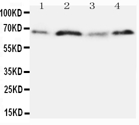 SPP1 / Osteopontin Antibody - Anti-Osteopontin antibody, Western blotting Lane 1: MM231 Cell LysateLane 2: HELA Cell LysateLane 3: JURKAT Cell LysateLane 4: COLO320 Cell Lysate