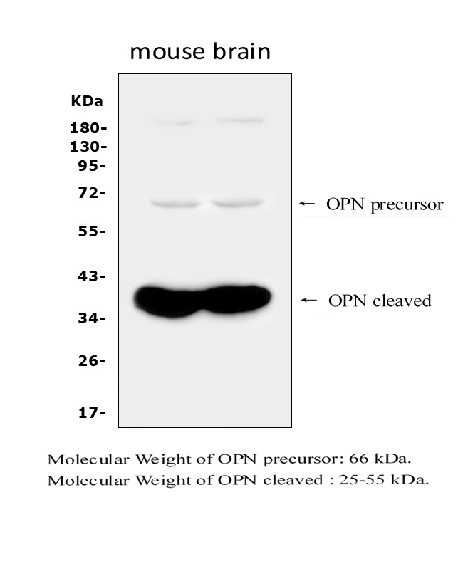 SPP1 / Osteopontin Antibody - Western blot analysis of OPN using anti-OPN antibody. Electrophoresis was performed on a 5-20% SDS-PAGE gel at 70V (Stacking gel) / 90V (Resolving gel) for 2-3 hours. The sample well of eachlane was loaded with 50ug of sample under reducing conditions. After Electrophoresis, proteins were transferred to a Nitrocellulosemembrane at 150mA for 60 minutes. Blocked the membrane with 5% Non-fat Milk/ TBS for 1.5 hour at RT. The membrane was incubated with rabbit anti-OPN antibody at 0.5ug/ml 4? overnight, then washed with TBS-0.1% Tween 3 times with 5 minutes each and probed with a goat anti-rabbit IgG-HRP secondary antibody at a dilution of 1:5000 for 1.5 hour at RT. The signal is developed using an Enhanced Chemiluminescent detection (ECL) kit with Tanon 5200 system. Specific bands were detected for OPN at approximately 66KD (OPN precursor) and 40KD (OPN cleaved).