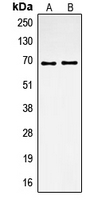 SPP1 / Osteopontin Antibody - Western blot analysis of Osteopontin expression in HEK293T (A); Jurkat (B) whole cell lysates.