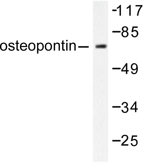 SPP1 / Osteopontin Antibody - Western blot of Osteopontin/SPP1 (L285) pAb in extracts from LOVO cells.