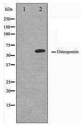SPP1 / Osteopontin Antibody - Western blot of LOVO cell lysate using Osteopontin Antibody