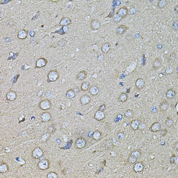 SPP1 / Osteopontin Antibody - Immunohistochemistry of paraffin-embedded rat brain using SPP1 antibody at dilution of 1:100 (40x lens).