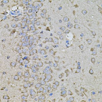 SPP1 / Osteopontin Antibody - Immunohistochemistry of paraffin-embedded mouse brain using SPP1 antibody at dilution of 1:100 (40x lens).
