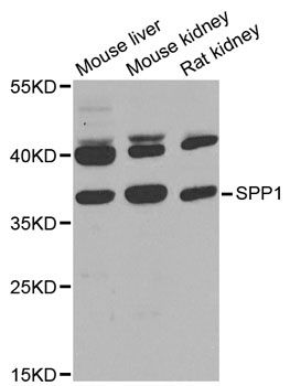 SPP1 / Osteopontin Antibody - Western blot analysis of extracts of various cell lines, using SPP1 antibody at 1:1000 dilution. The secondary antibody used was an HRP Goat Anti-Rabbit IgG (H+L) at 1:10000 dilution. Lysates were loaded 25ug per lane and 3% nonfat dry milk in TBST was used for blocking. An ECL Kit was used for detection and the exposure time was 15s.