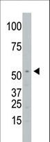 SPPL2A / IMP3 Antibody - The anti-SPPL2a antibody is used in Western blot to detect SPPL2a in Jurkat cell lysate.