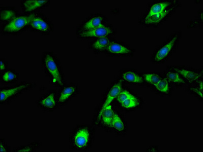 SPPL2A / IMP3 Antibody - Immunofluorescent analysis of Hela cells using SPPL2A Antibody at dilution of 1:100 and Alexa Fluor 488-congugated AffiniPure Goat Anti-Rabbit IgG(H+L)