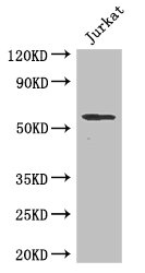 SPPL2A / IMP3 Antibody - Western Blot Positive WB detected in: Jurkat whole cell lysate All lanes: SPPL2A antibody at 2µg/ml Secondary Goat polyclonal to rabbit IgG at 1/50000 dilution Predicted band size: 59 kDa Observed band size: 59 kDa