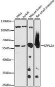 SPPL2A / IMP3 Antibody - Western blot analysis of extracts of various cell lines, using SPPL2A antibody at 1:1000 dilution. The secondary antibody used was an HRP Goat Anti-Rabbit IgG (H+L) at 1:10000 dilution. Lysates were loaded 25ug per lane and 3% nonfat dry milk in TBST was used for blocking. An ECL Kit was used for detection and the exposure time was 5s.