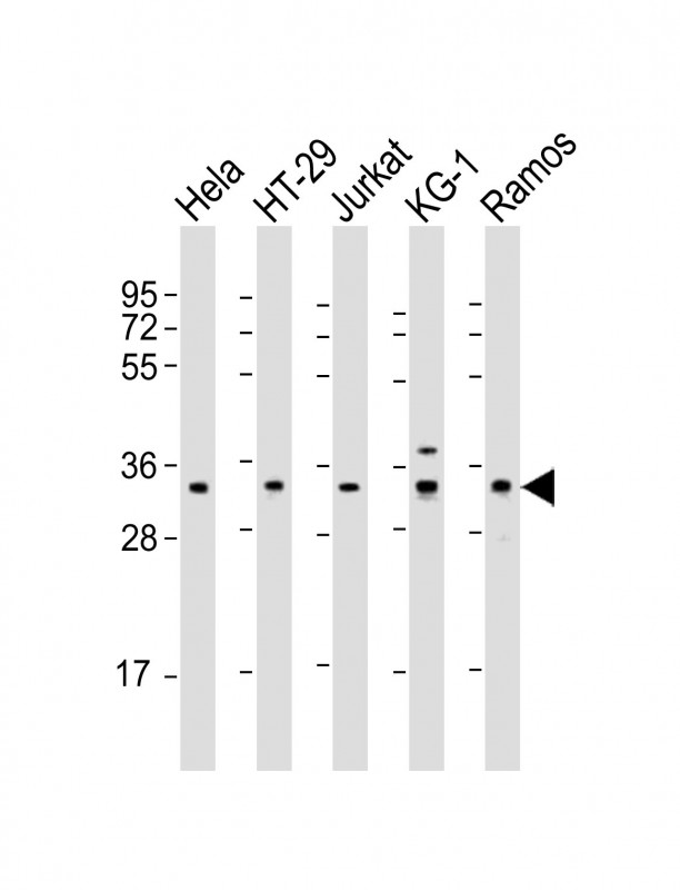SPPL2B Antibody - All lanes: Anti-SPPL2B Antibody (N-Term) at 1:2000 dilution. Lane 1: HeLa whole cell lysate. Lane 2: HT-29 whole cell lysate. Lane 3: Jurkat whole cell lysate. Lane 4: KG-1 whole cell lysate. Lane 5: Ramos whole cell lysate Lysates/proteins at 20 ug per lane. Secondary Goat Anti-Rabbit IgG, (H+L), Peroxidase conjugated at 1:10000 dilution. Predicted band size: 65 kDa. Blocking/Dilution buffer: 5% NFDM/TBST.